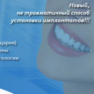 Новый,  не травматичный способ установки имплантатов!