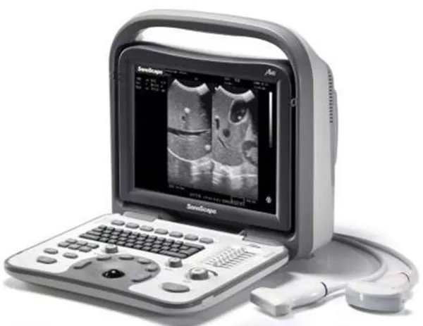 Ветеринарный УЗИ аппарат SonoScape A6V