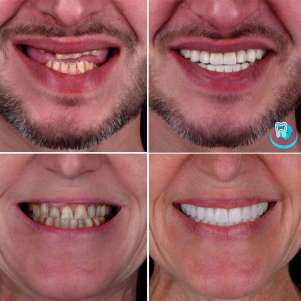 Клініка Са-Ната: лікування зубів у Києві