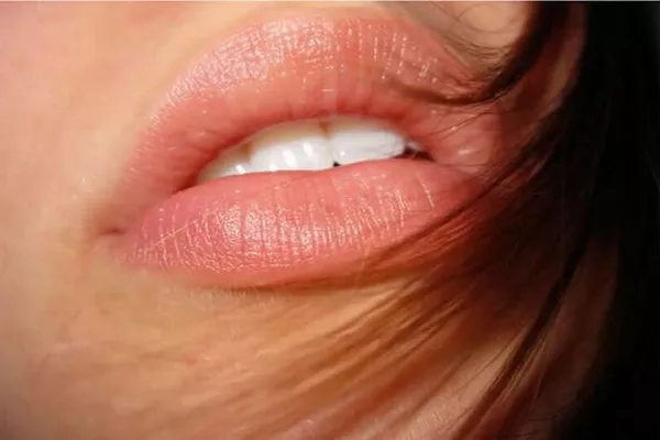 Увеличение губ/скул,  контурная пластика,  коррекция,  косметические услу