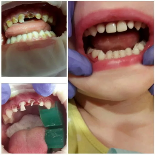 Детская стоматология Multident в Киеве 2